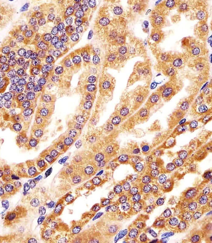 Polyclonal Rabbit anti-Human GMCL1 Antibody (aa281-315, IHC, WB)