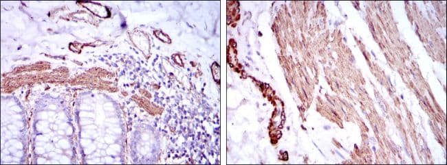 ACTA2 / Smooth Muscle Actin Antibody (clone 4A4)