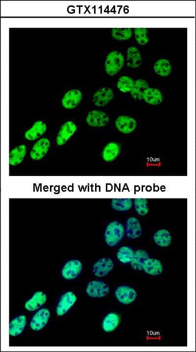 HNRNPF / hnRNP F Antibody (aa1-204)
