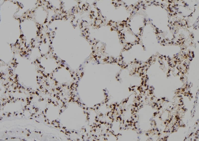 SIP1 Antibody