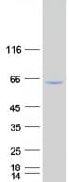 Human RELA / NFKB p65 Protein (Recombinant Myc-DDK (Flag))