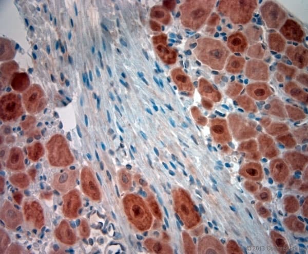 Polyclonal Rabbit anti-Human NeuN Antibody (aa80-130, IHC, WB)