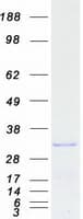 Human REEP3 Protein (Recombinant Myc-DDK (Flag))
