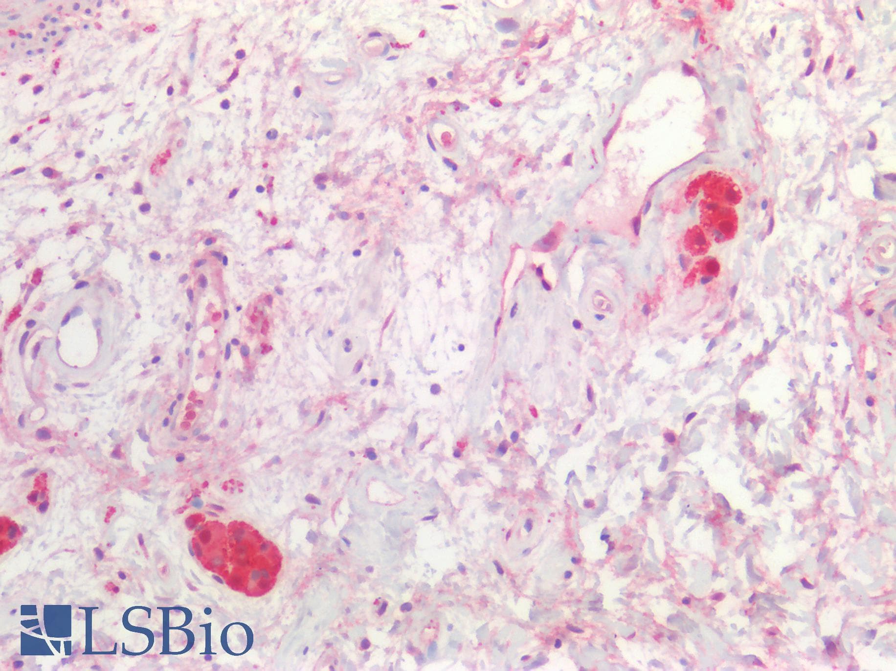 PathPlus™ SNCA / Alpha-Synuclein Antibody