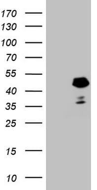 DMRT1 Antibody (aa1-210, clone OTI3G10)