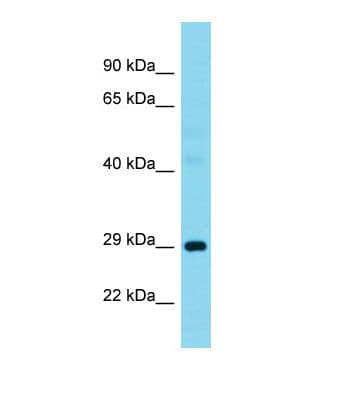 Polyclonal Rabbit anti-Human G3BP1 / G3BP Antibody (N-Terminus, WB)