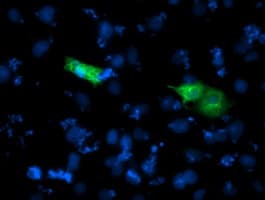 Monoclonal Mouse anti-Human SHPK / CARKL Antibody (clone OTI3D7, IHC, IF, WB)