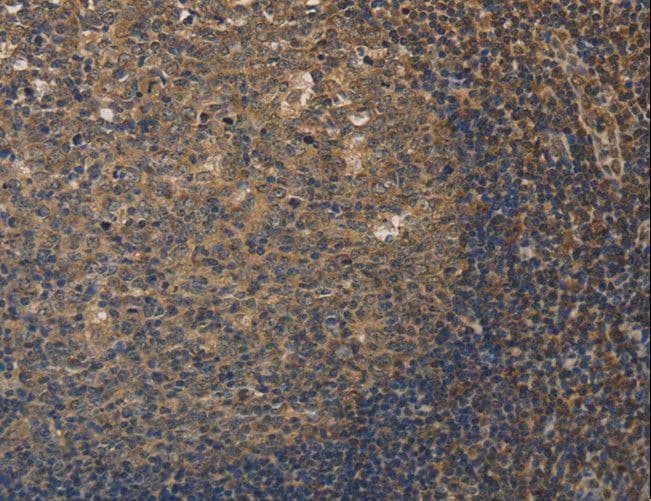 DDX19B Antibody