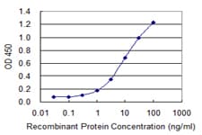 VWF / Von Willebrand Factor Antibody (clone 1A11)