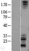 NOTCH1 Protein (Over-Expression Lysate Myc-DDK (Flag))