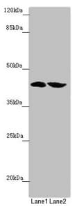 Polyclonal Rabbit anti-Human FBXO22 Antibody (IHC, WB)