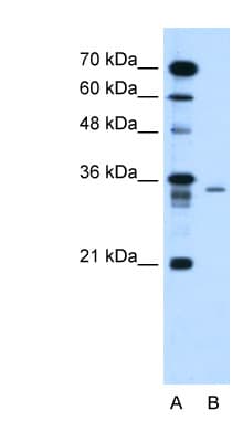 Polyclonal Rabbit anti-Human LY6G6F Antibody (aa51-100, IHC, WB)