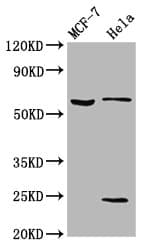 Polyclonal Rabbit anti-Human SLC45A2 Antibody (WB)