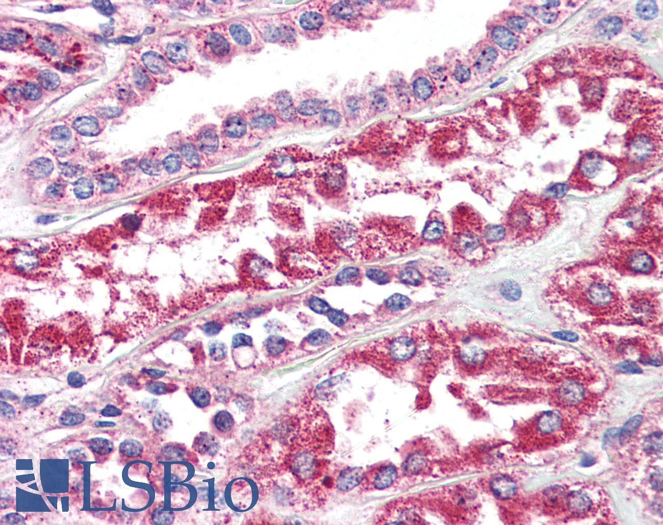 IHC-plus™ Polyclonal Rabbit anti-Human PTGER2 / EP2 Antibody (Internal, IHC)