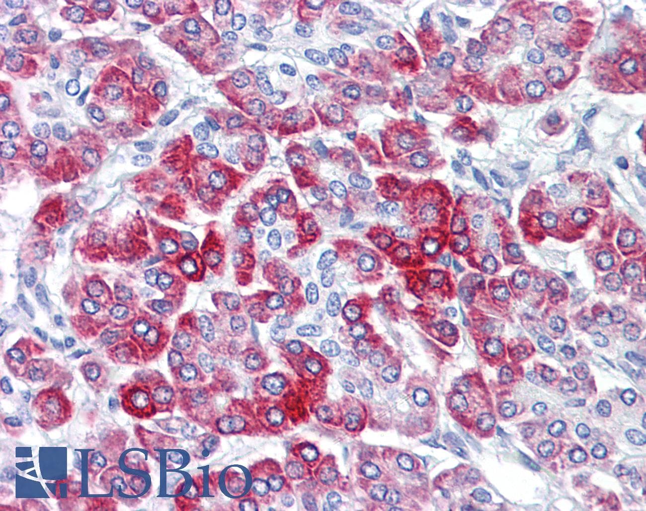 IHC-plus™ RPS6 / Ribosomal Protein S6 Antibody (aa191-240)
