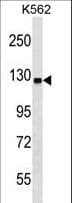 UBE1L2 / UBE1L2 Antibody (aa861-889)