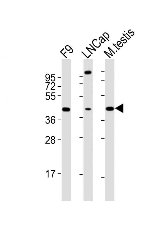 SOX17 Antibody (aa353-387)