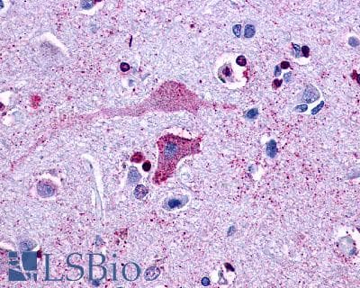 PathPlus™ CCR10 / GPR2 Antibody (Extracellular Domain)