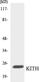 TK1 / TK / Thymidine Kinase Antibody (aa144-193)