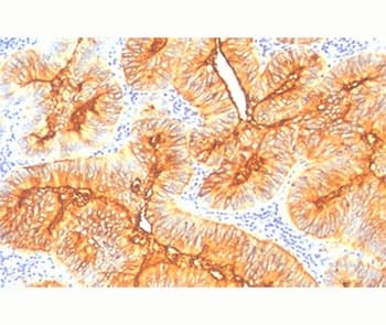 TAG-72 Antibody (clone B72.3, Ready-to-Use)