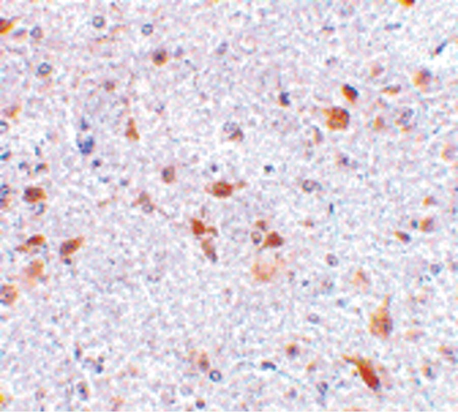 PD-L2 / PDCD1LG2 / CD273 Antibody