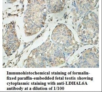 Polyclonal Rabbit anti-Human LDHAL6A Antibody (aa10-190, IHC, WB)