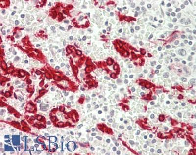 IHC-plus™ Polyclonal Rabbit anti-Human TMPRSS11E Antibody (aa249-277, IHC, WB)