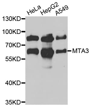 MTA3 Antibody