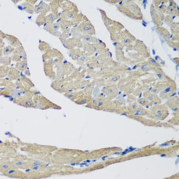 Polyclonal Rabbit anti-Human SMYD1 Antibody (IHC, IF, WB)