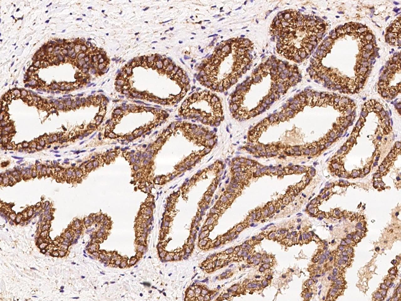 AMIGO2 Antibody