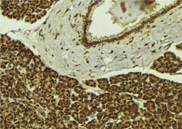 Polyclonal Rabbit anti-Human UBR2 Antibody (IHC, WB)