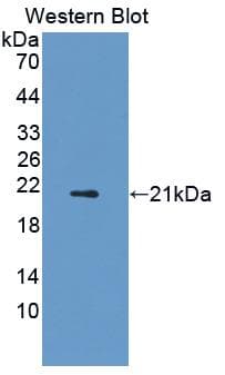 ADIPOR2 Antibody (aa1-147)