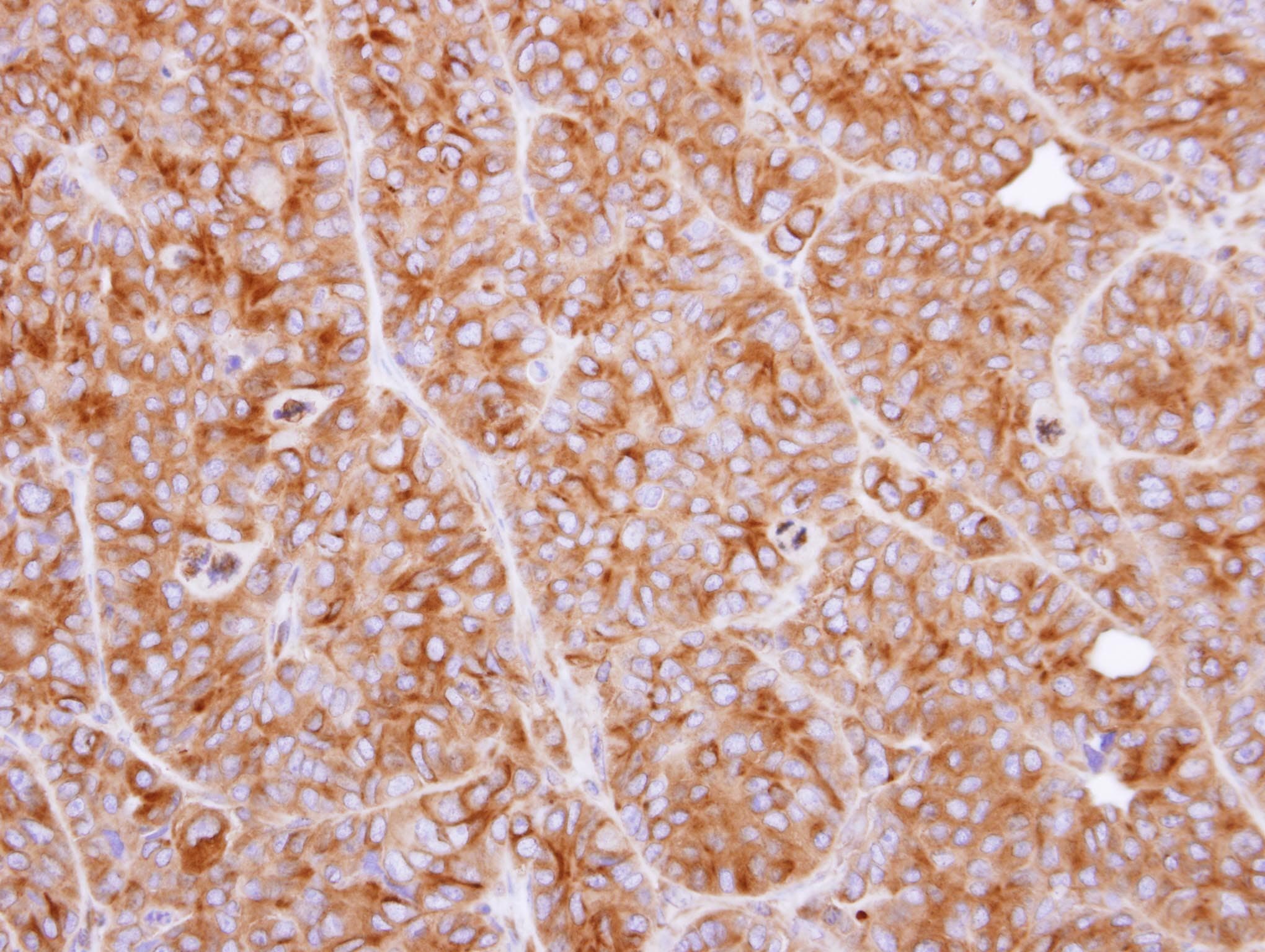 IHC-plus™ TPP1 / CLN2 Antibody (aa66-324)