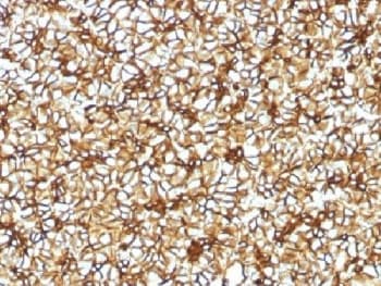 SPTBN2 Antibody (clone SPTBN2/1582, Azide-free, BSA-free)