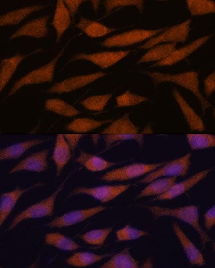 DDX31 Antibody