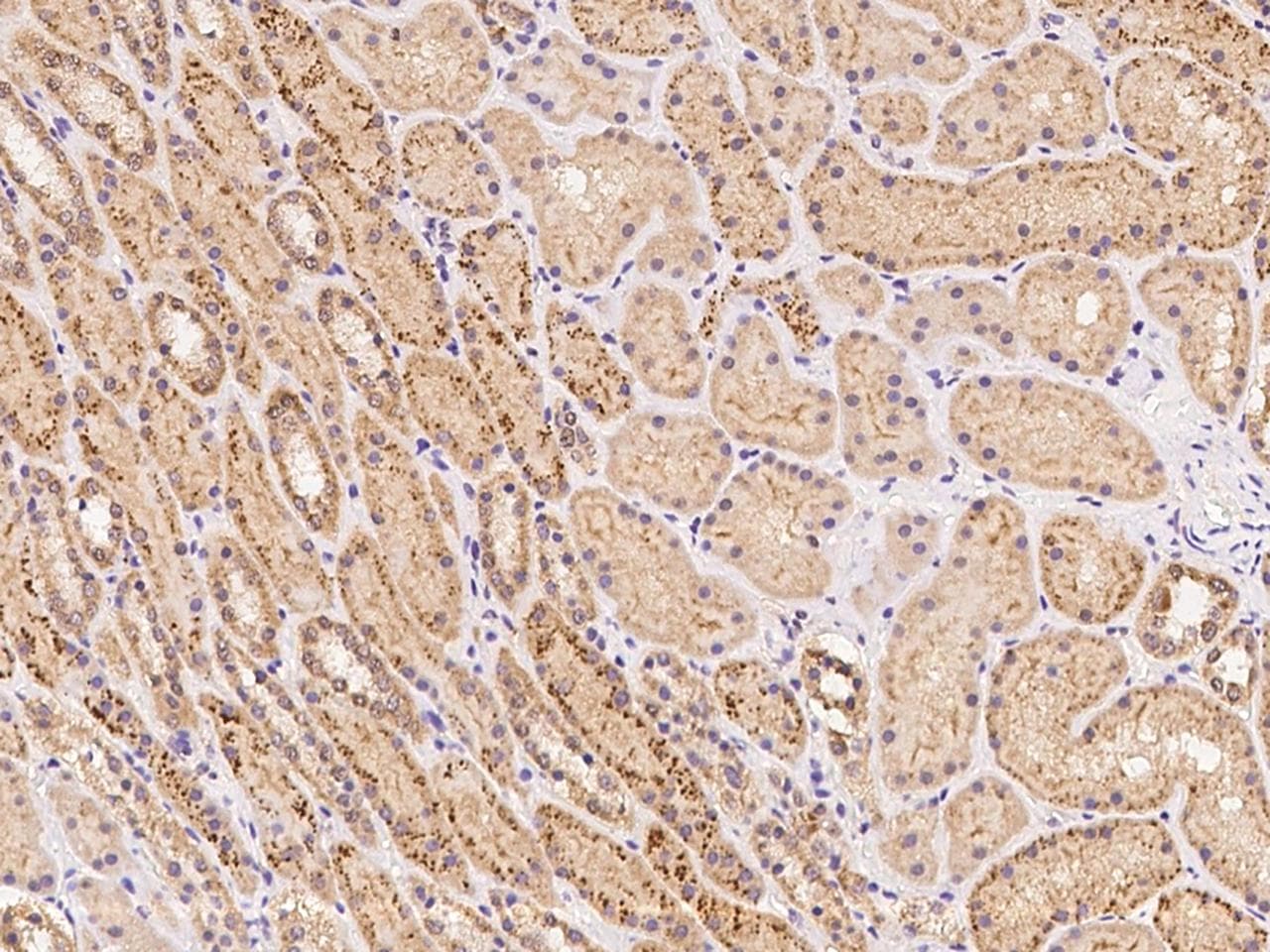 Polyclonal Rabbit anti-Human KIAA1958 Antibody (IHC)