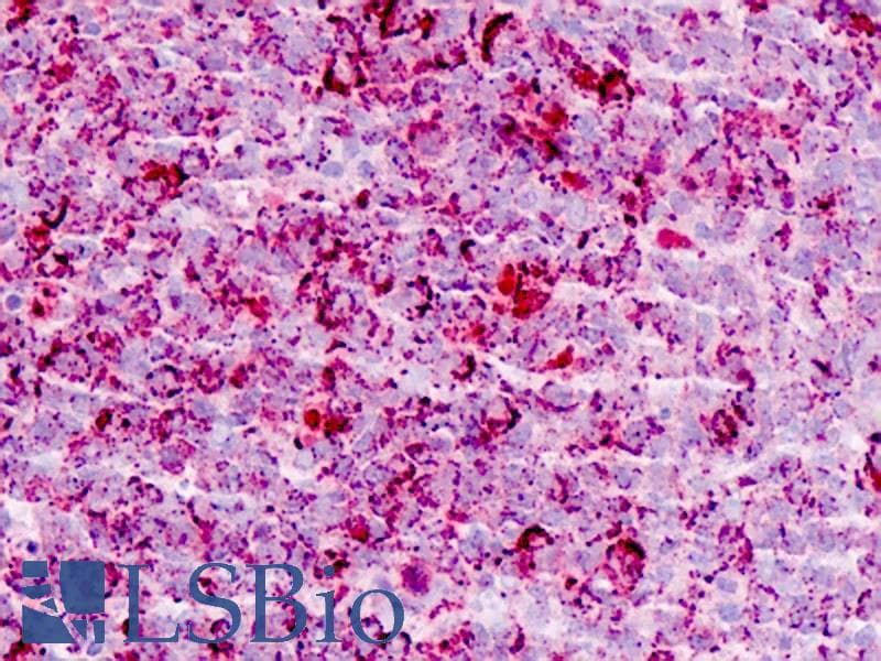 IHC-plus™ CHEK1 / CHK1 Antibody (Ser280)