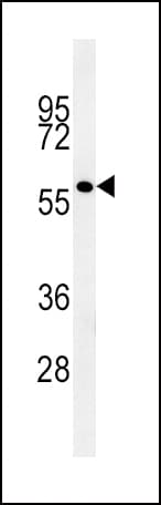 IHC-plus™ GP6 / GPVI Antibody (aa309-337)