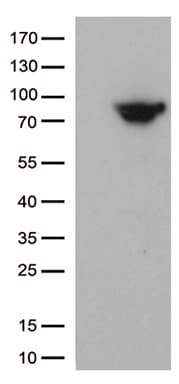 MTHFR Antibody (aa1-230, clone OTI4D2)