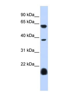 HTR3E / 5-HT3E Receptor Antibody (aa360-409)