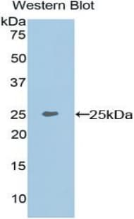 MEPE Antibody (aa28-224)