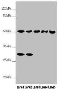 Polyclonal Rabbit anti-Human PPP2R3C Antibody (IHC, WB)