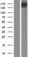 TNS2 / TENC1 Protein (Over-Expression Lysate Myc-DDK (Flag))