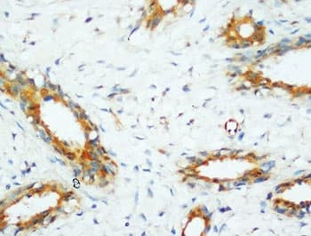 PP2Ac / PPP2CA Antibody (aa6-20)