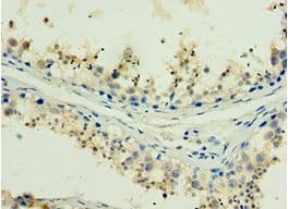 Polyclonal Rabbit anti-Human H2AFX / H2AX Antibody (aa1-143, IHC)