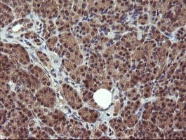 PPAT Antibody (aa42-278, clone OTI1B11)