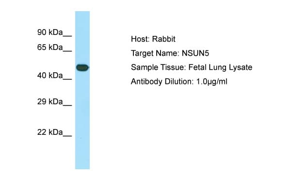 NSUN5 Antibody (C-Terminus)
