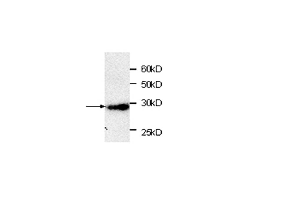 RFP Tag Antibody (aa21-245)