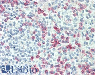 IHC-plus™ Monoclonal Mouse anti-Human C5AR1 / CD88 / C5a Receptor Antibody (clone P12/1, IHC, WB)