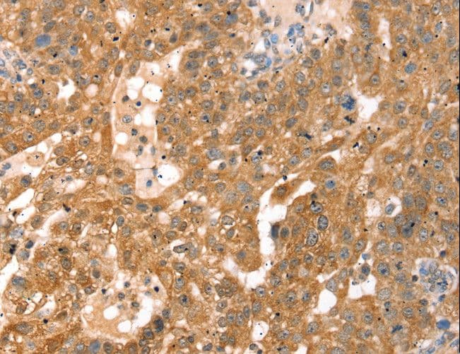 RPS6KA1 / RSK1 Antibody